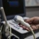 AI performed well in conducting preliminary readings of heart ultrasounds