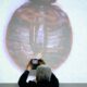 South Korea has seen a surge in bedbug infestations, with more than 100 cases reported since late November
